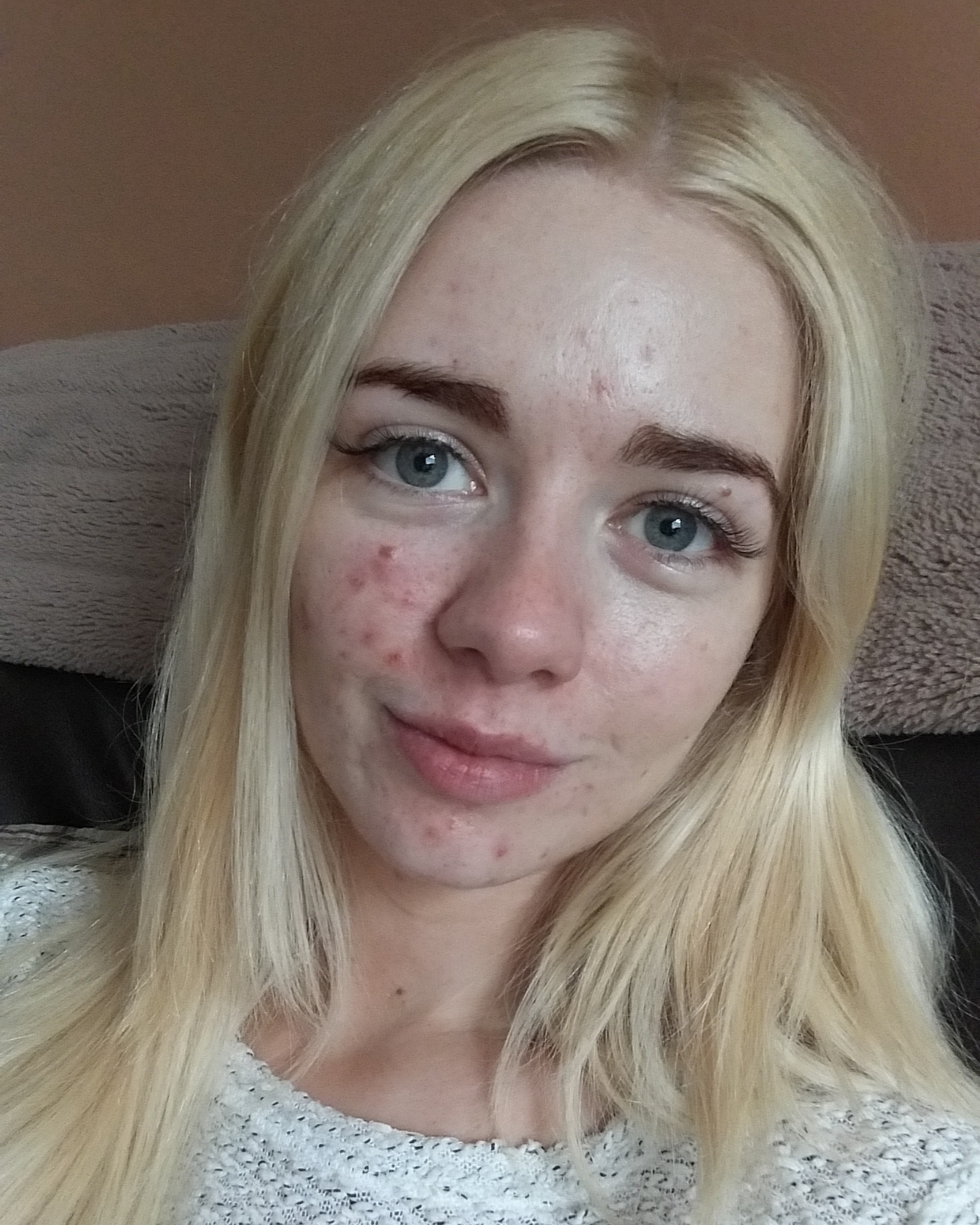Hannah Shields acne selfie