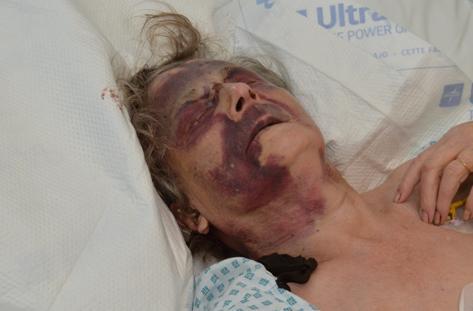 Iris Warner was left seriously injured (Met Police/PA)