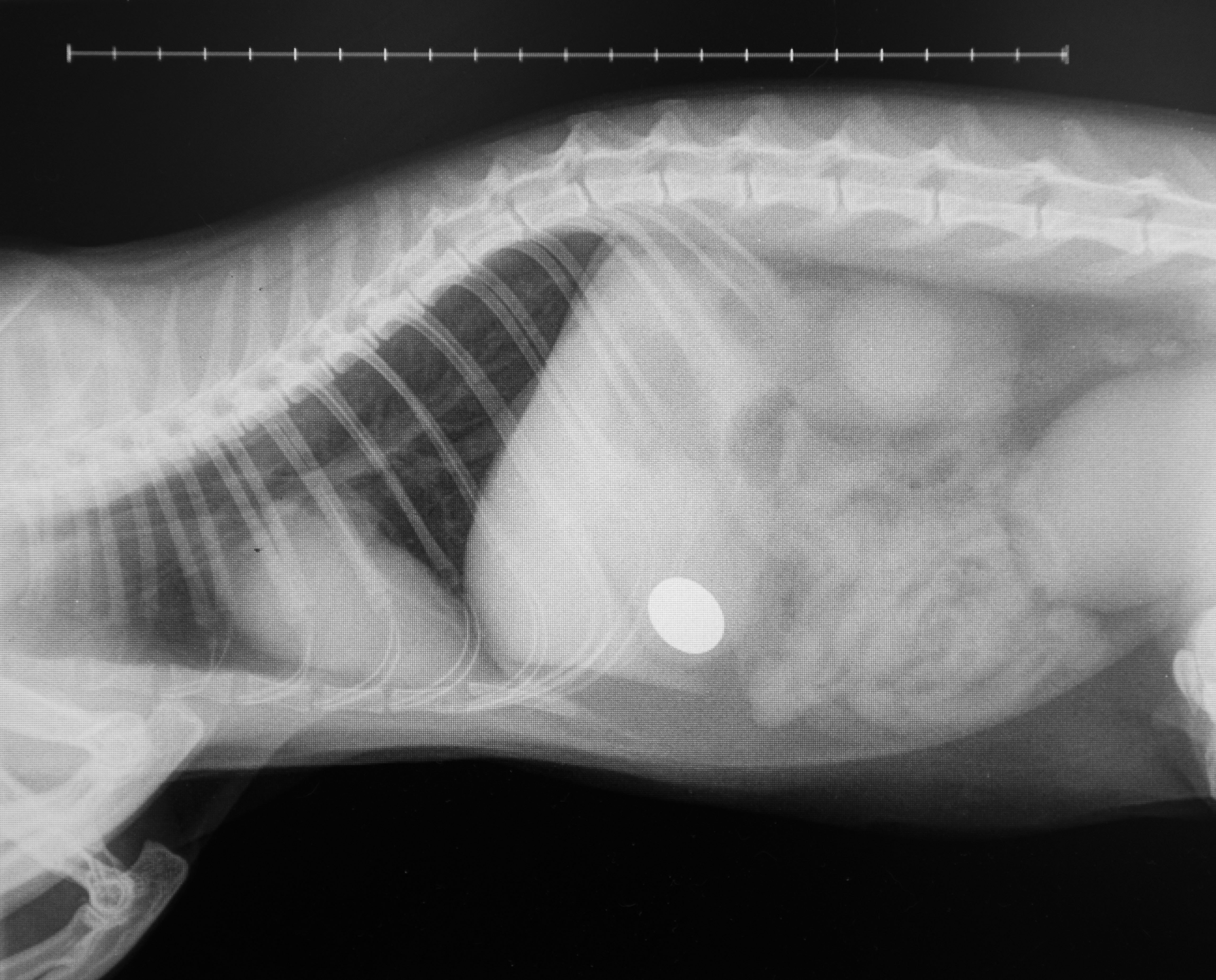 An X-ray showing the 5p coin