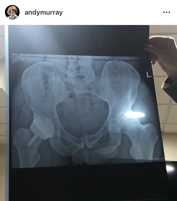 Andy Murray's hip