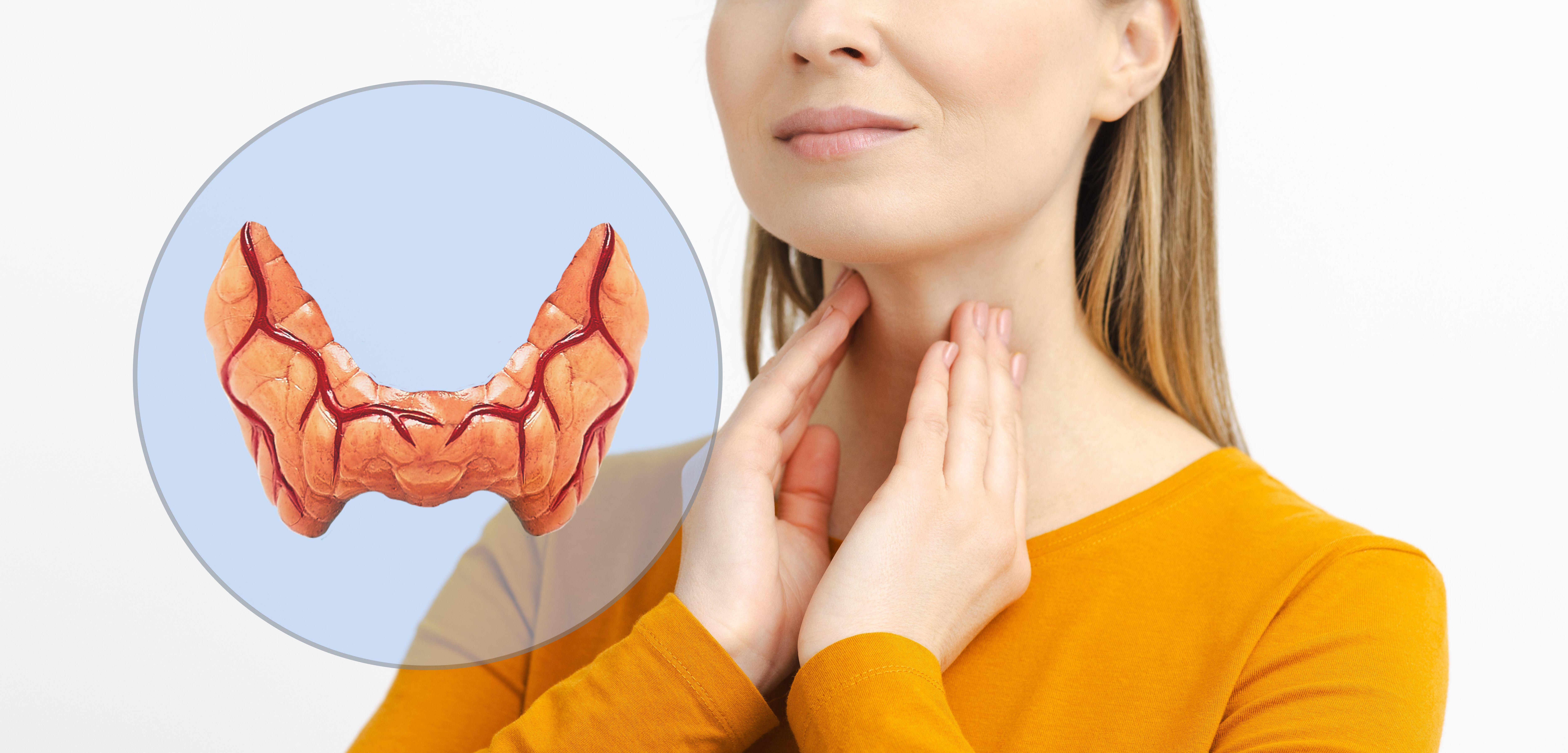 Woman self touching her neck to check the thyroid gland with close-up showing enlarged thyroid.
