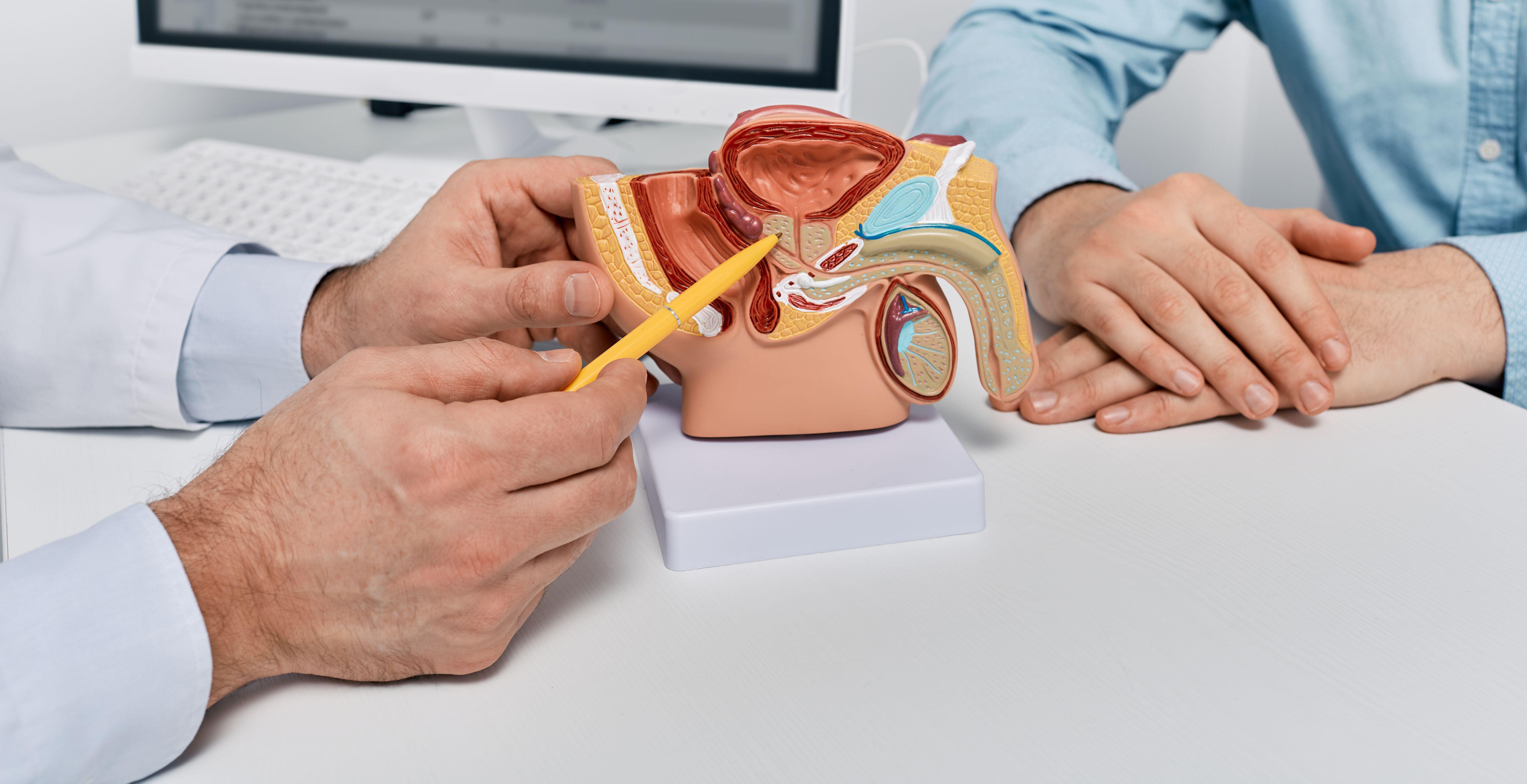 A doctor consulting a male patient using a pen to point at a reproductive system model
