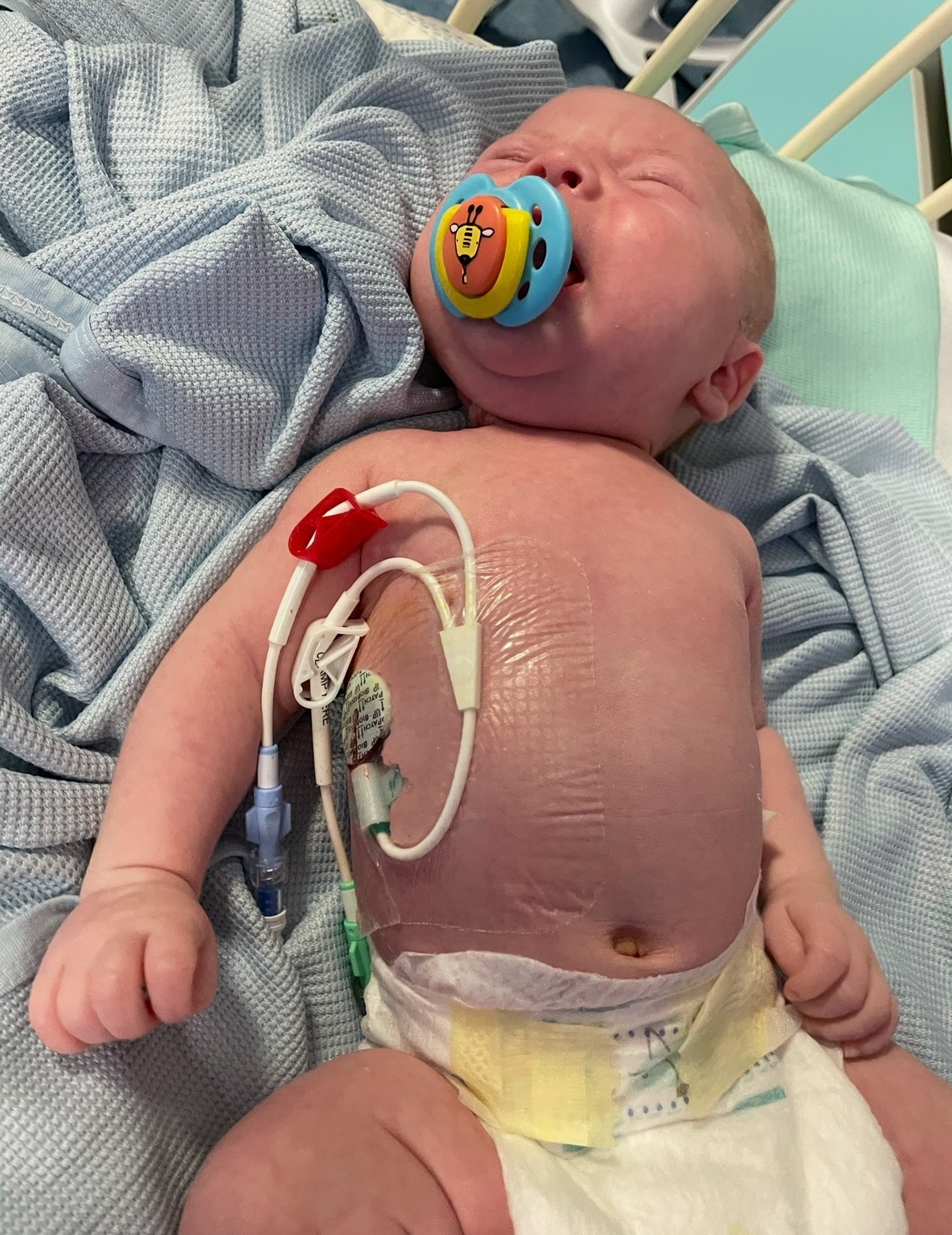 Joey in hospital