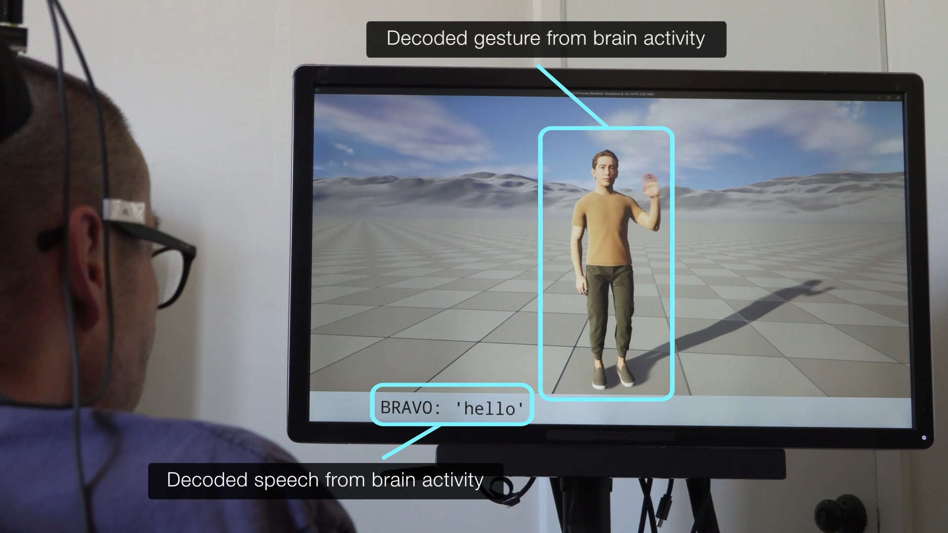 A paralysed patient using an avatar to create speech and movement simultaneously
