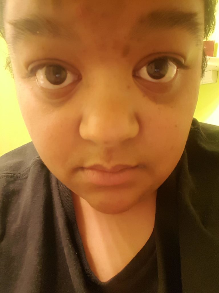 A woman who can pop her eyes out of her head has answered the questions Express & Star