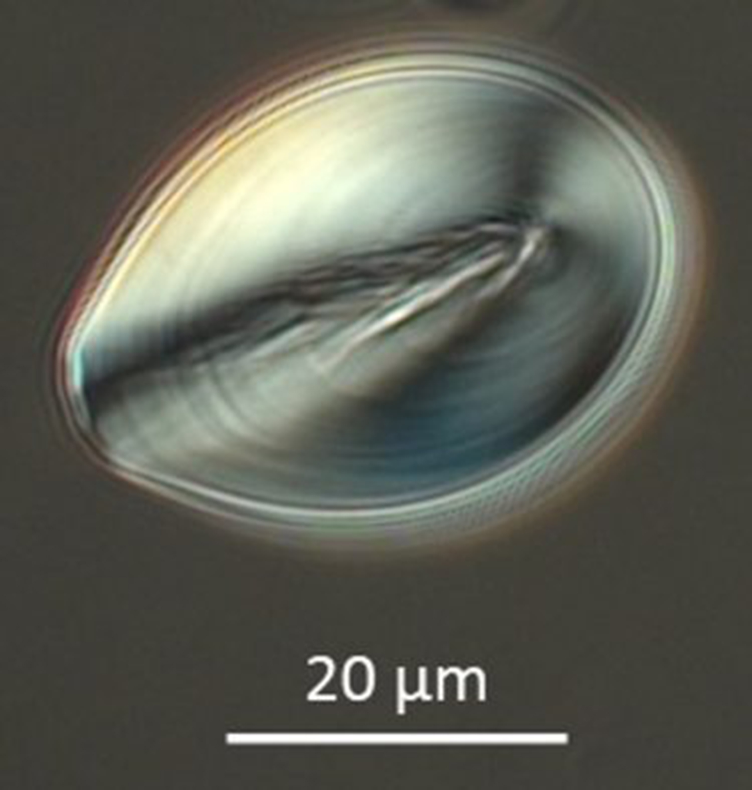 A microscopic starch granules from the Four Corners potato.