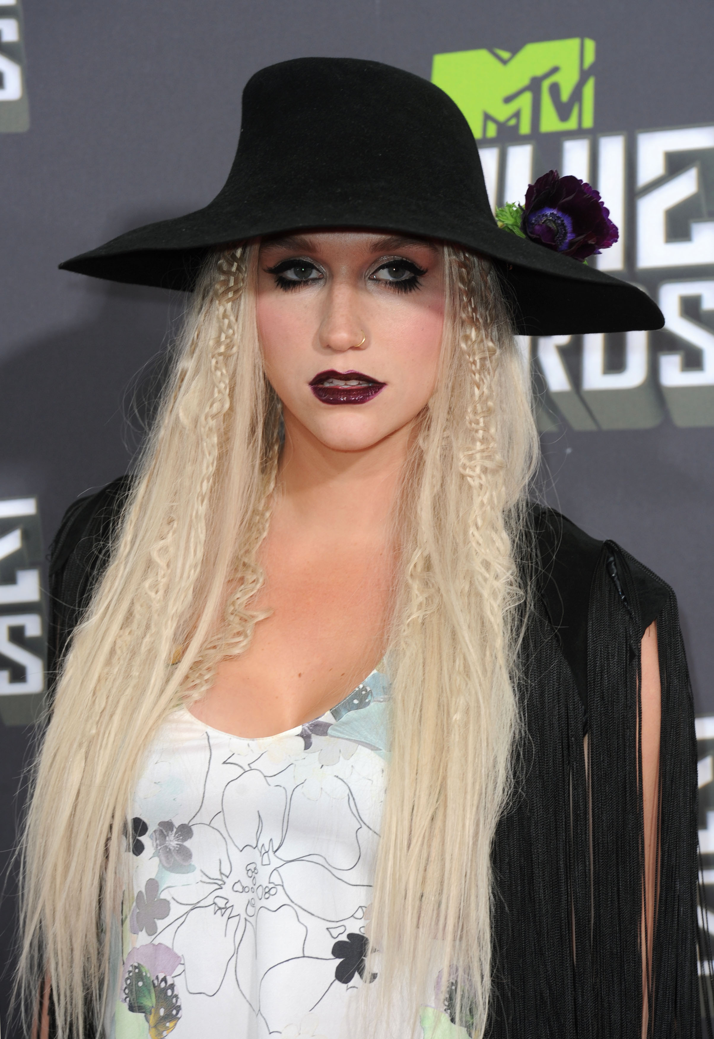 Kesha