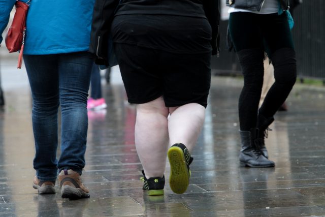 The legs of an overweight woman