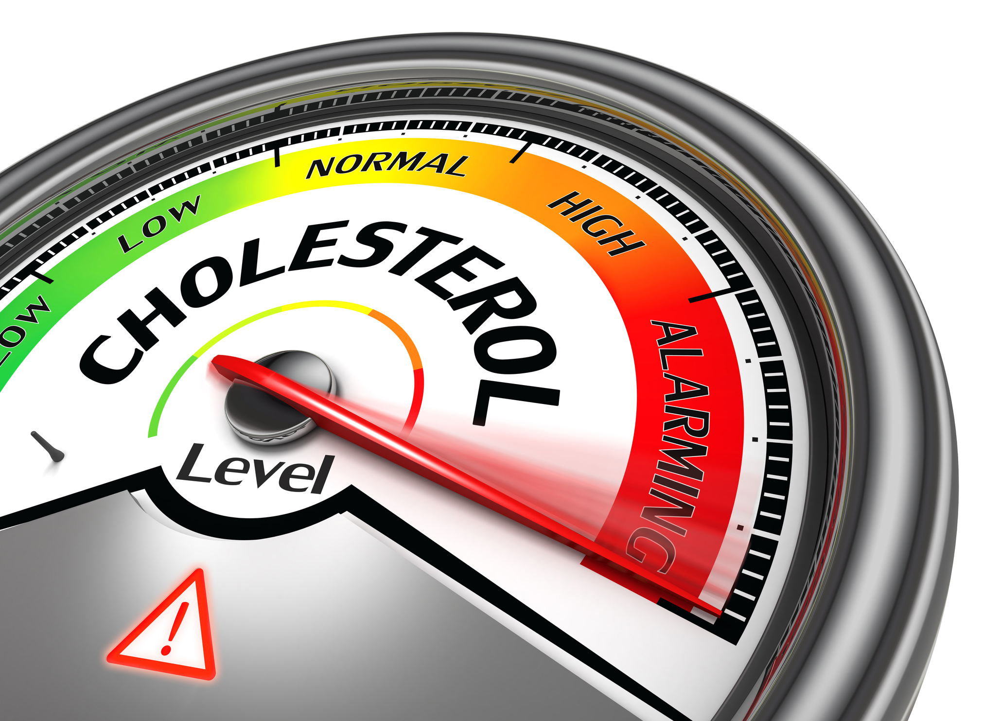 Cholesterol illustration.