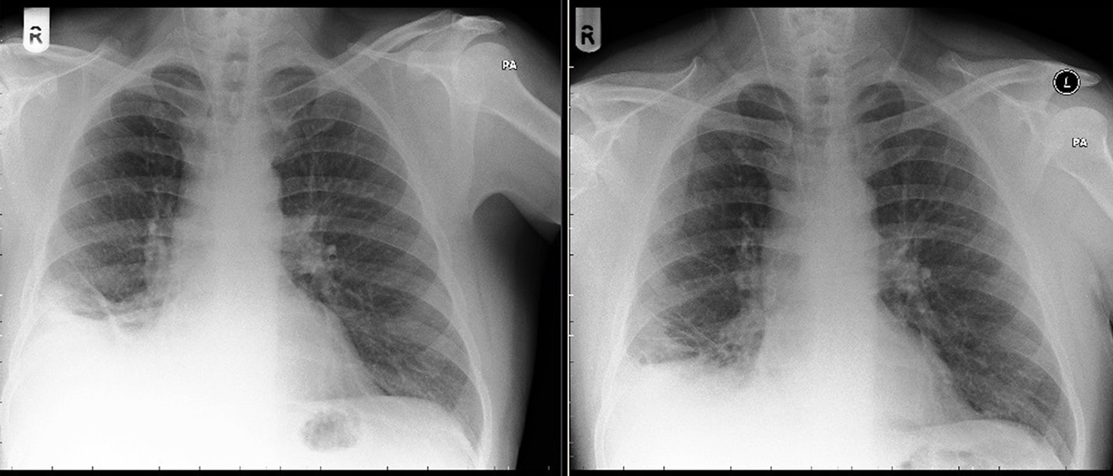 lung cancer in dogs x ray pictures