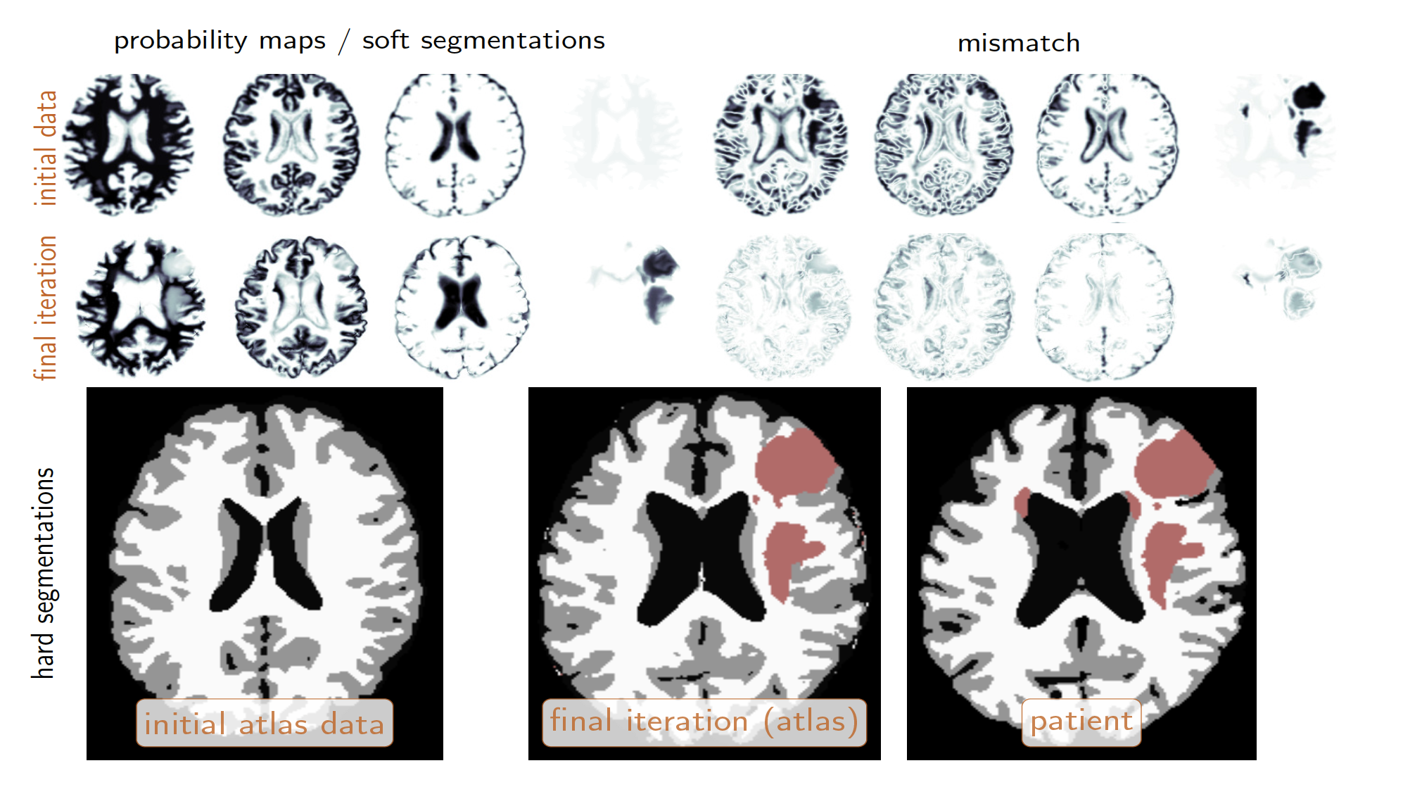 MR brain scans showing different parts of the brain highlighted