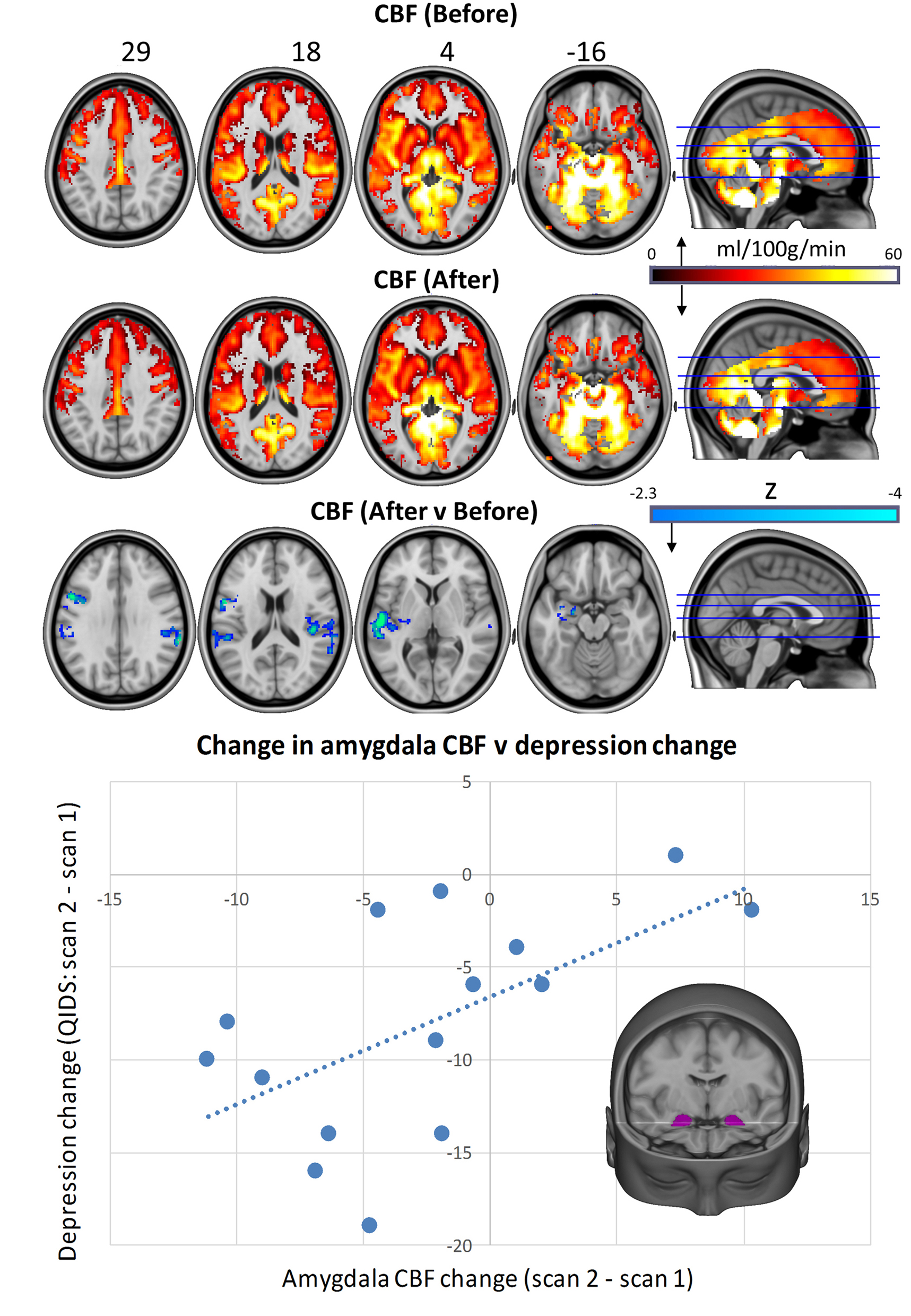 Brain MRI scans.