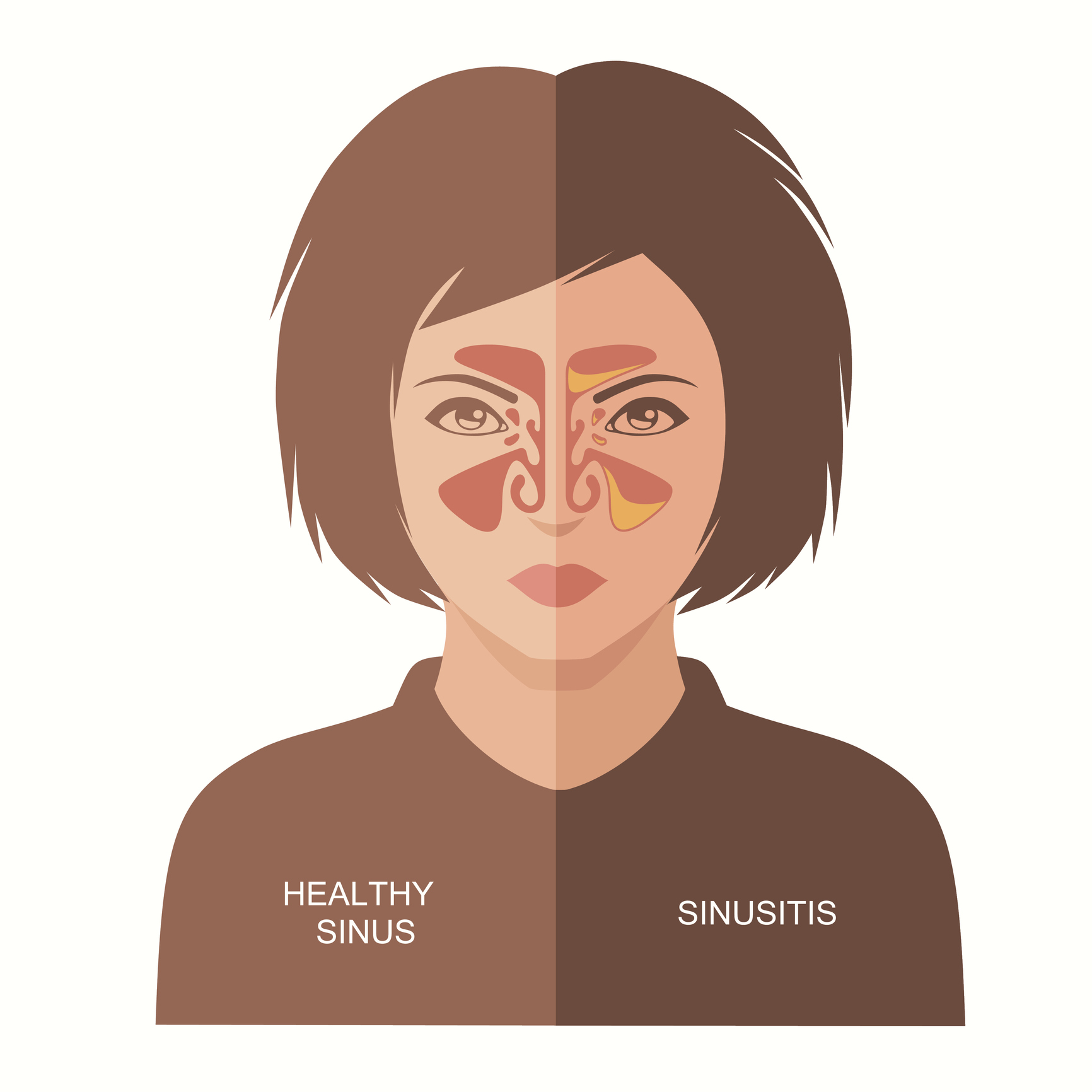 Generic illustration showing the sinuses (Thinkstock/PA)