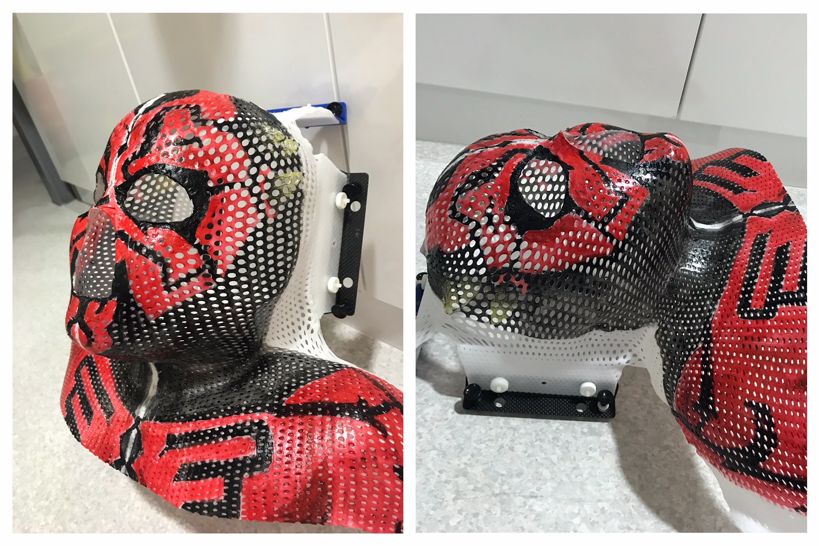 A mask made for a young radiotherapy patient (Lobke Marsden/St James' Hospital)