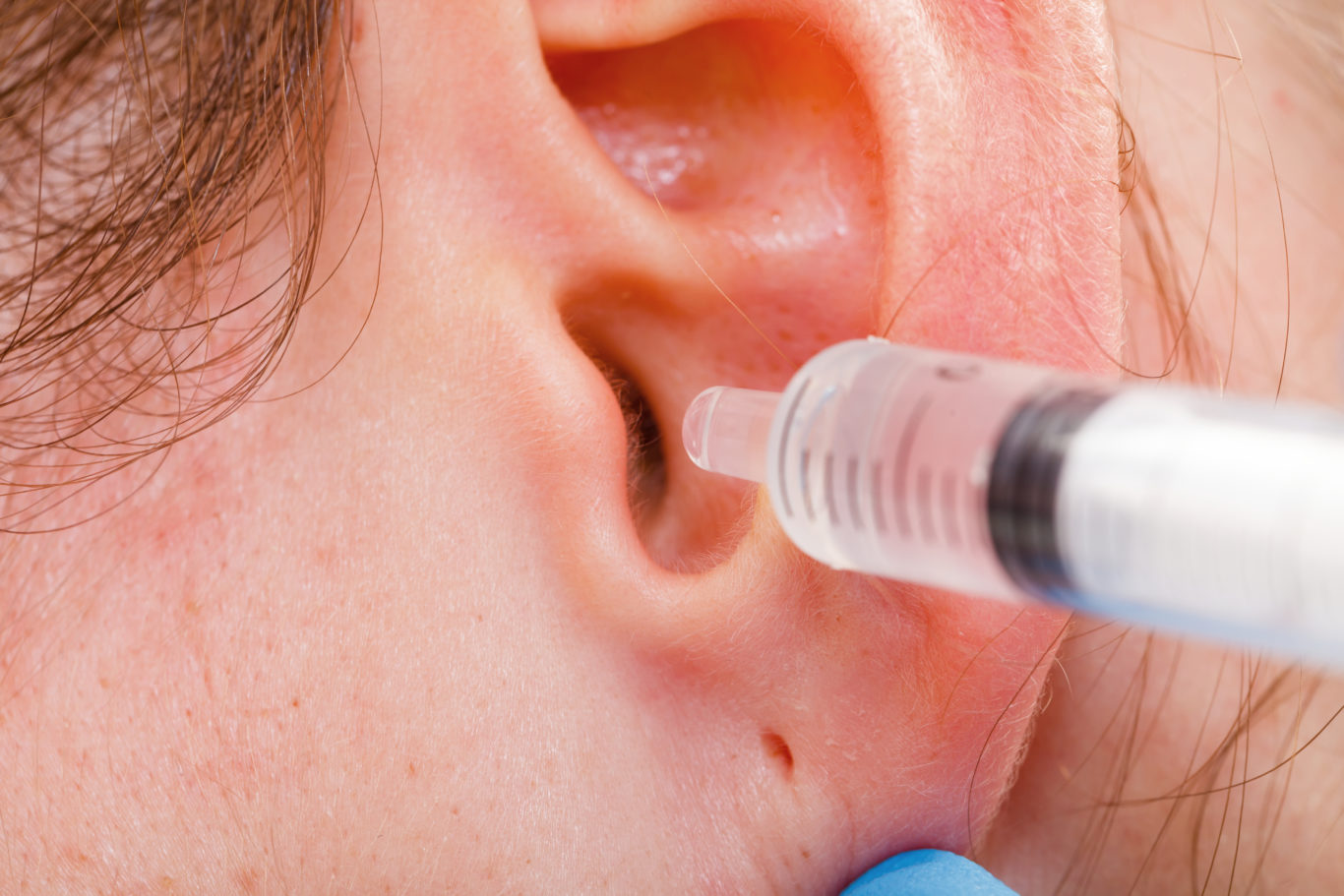 Here’s why you shouldn’t use cotton buds to clean your ears