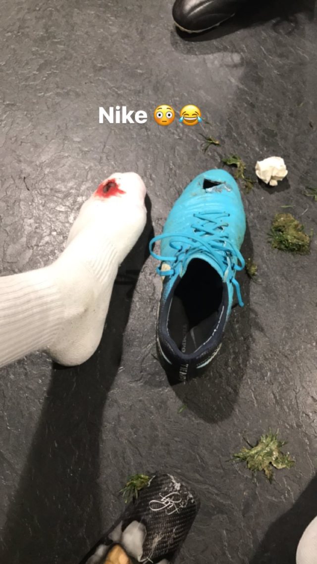 Antonio Rudiger's foot and boot in an Instagram post by Chelsea team-mate Michy Batshuayi