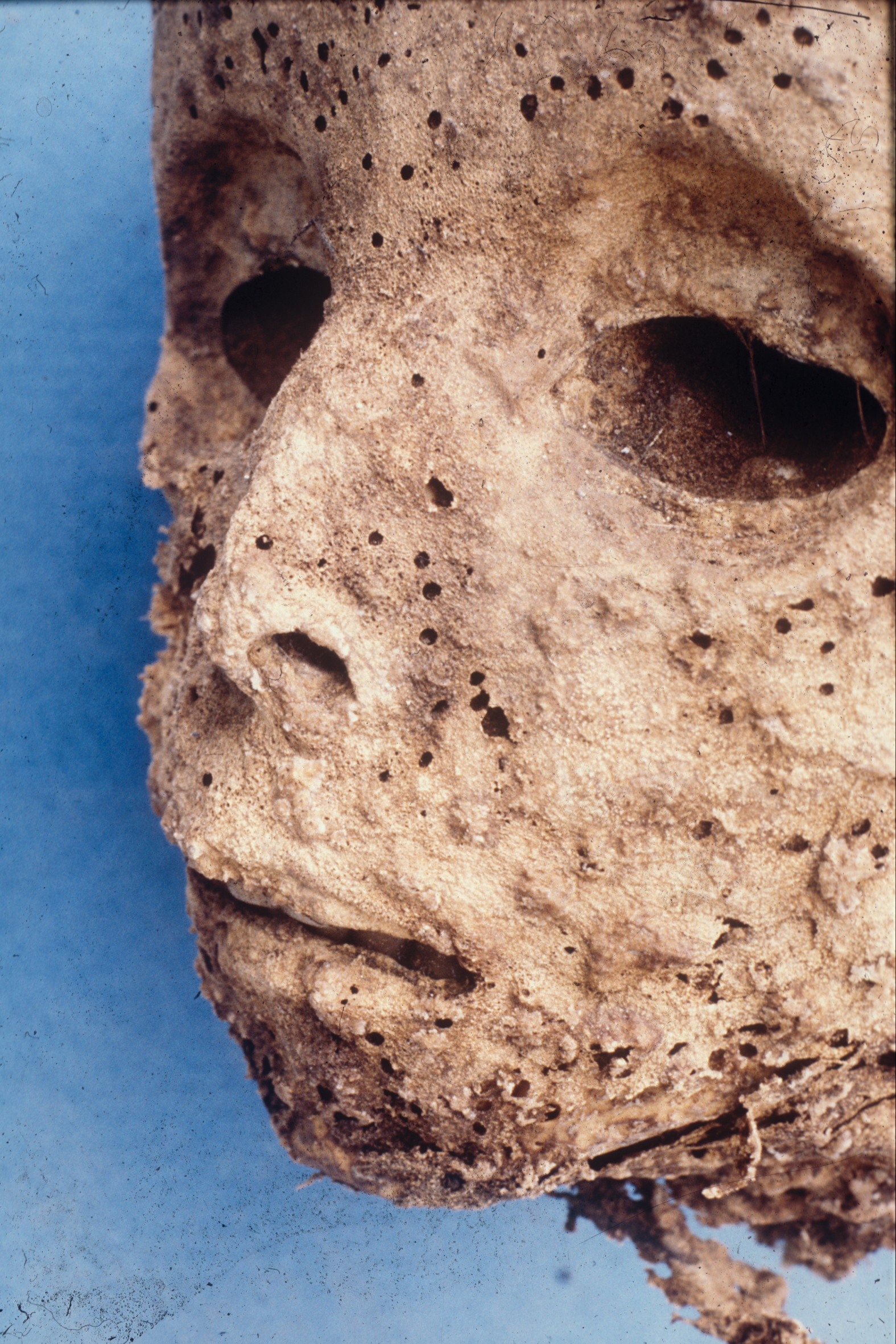 The mummified remains of a small child buried in the Basilica of Saint Domenico Maggiore in Naples, Italy