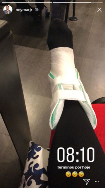 Neymar posted a picture on Instagram showing his ankle heavily strapped