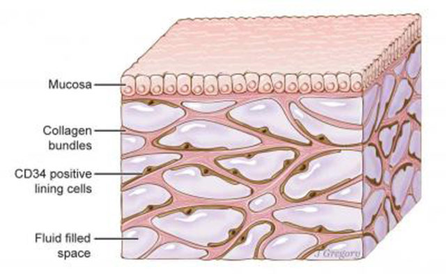 An illustration of the interstitium, is seen here beneath the top layer of skin.