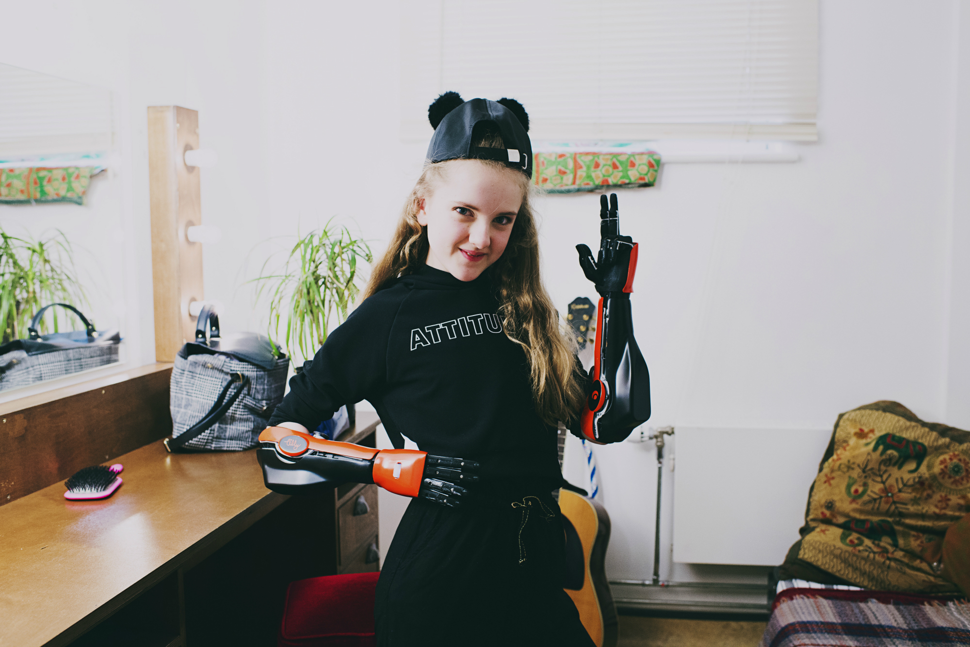 World’s First 3D-printed Arms For Amputees Created By Open Bionics | BT