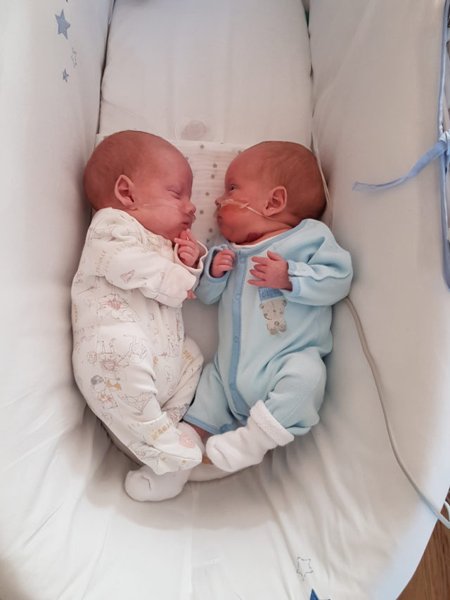 Parents of twins who were born in same amniotic sac desperate to help