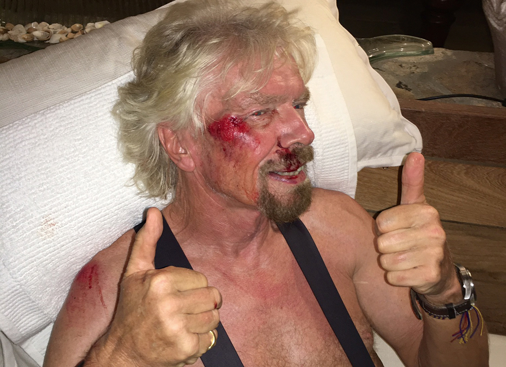 Branson just after his cycling accident in 2016 (Branson Family/PA
