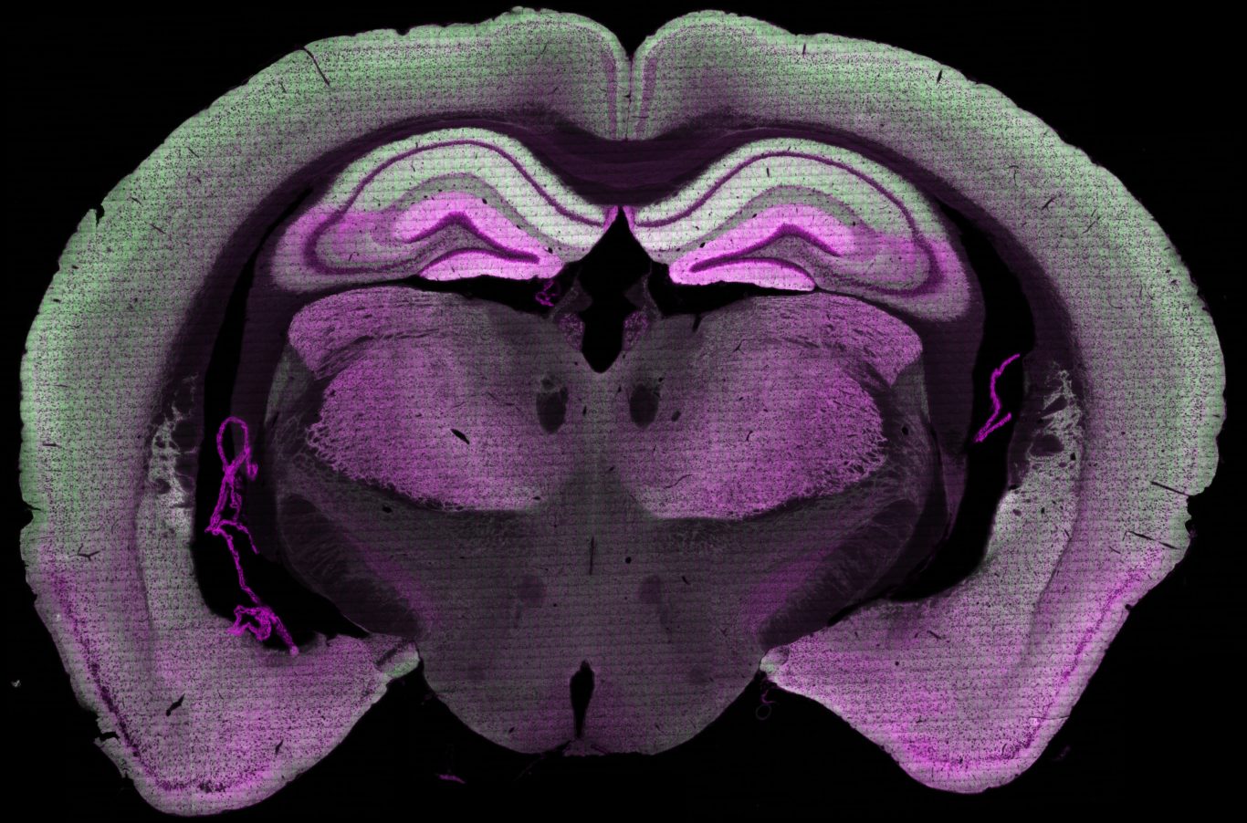 Amazing brain. Mouse Brain. Мозг link. Brain Mouse and Human. Brain Maps youtube.