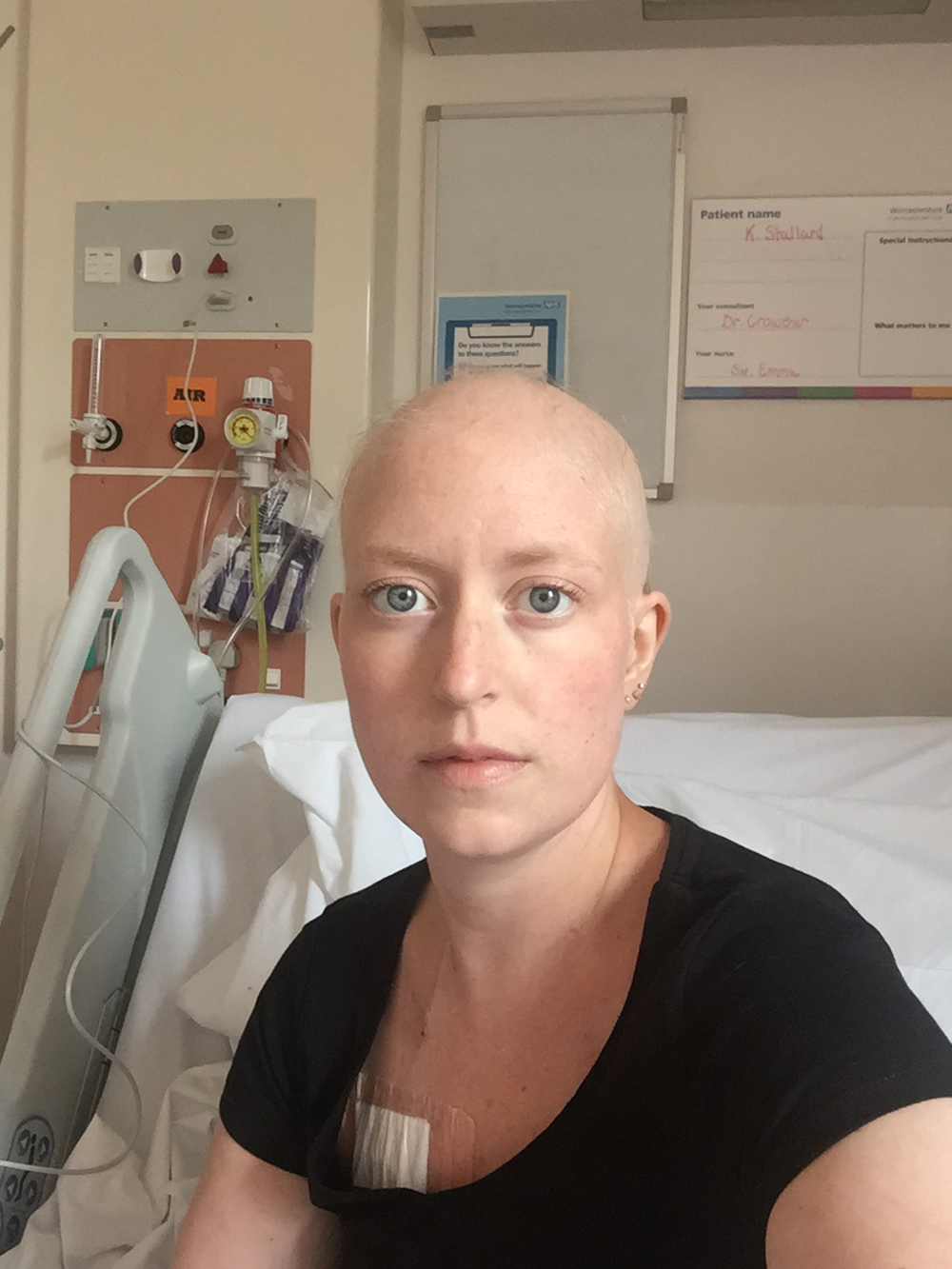 волосы после химиотерапии через год фото