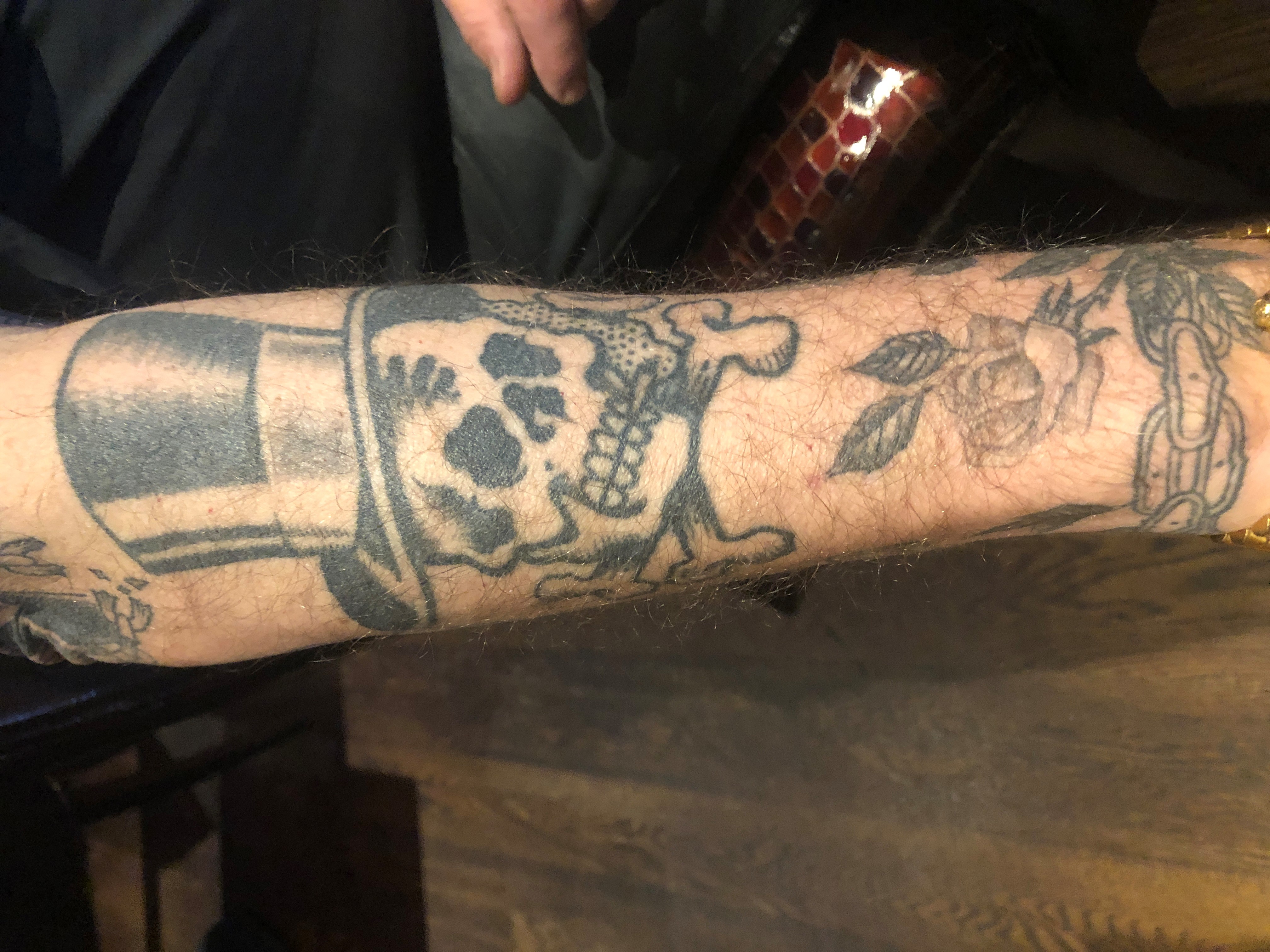 The picture from Mark of his arm