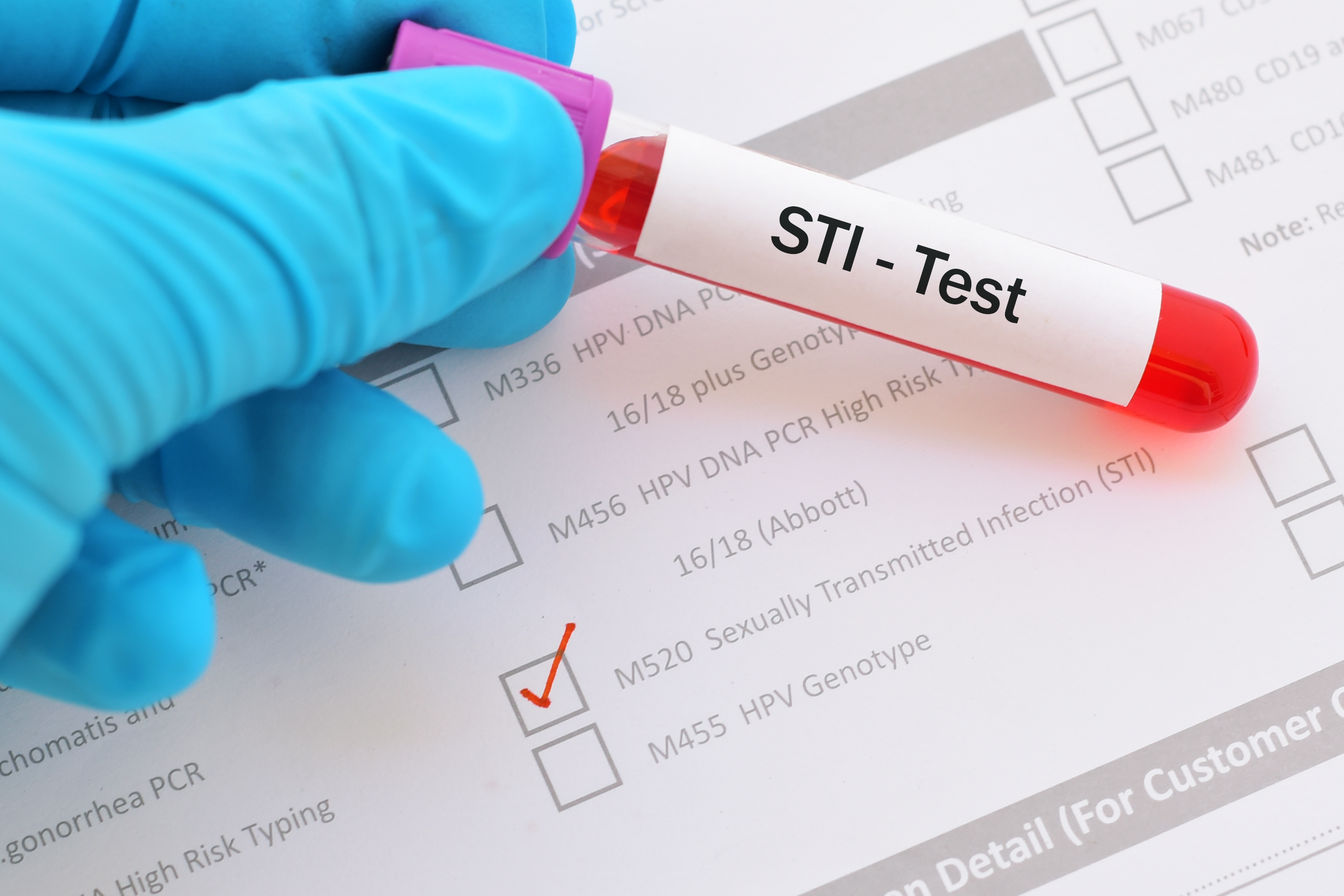 Blood sample for sexually transmitted infection (STI) test