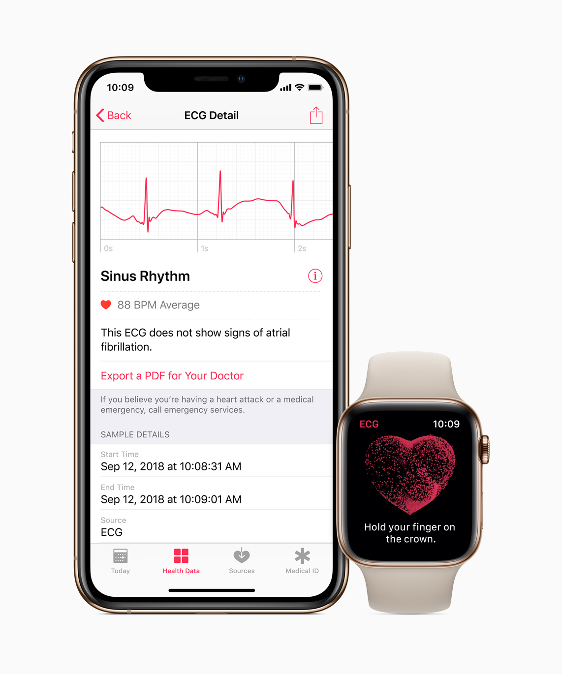 ECG app on the Apple Watch