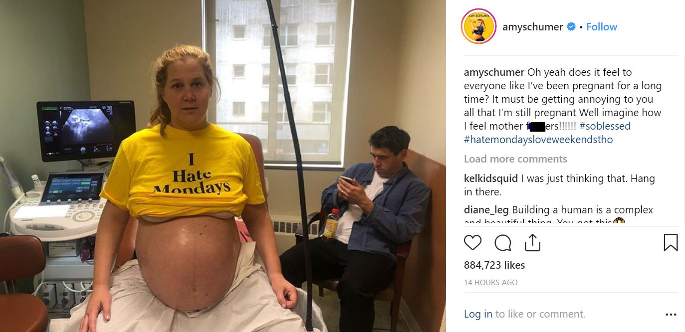 Amy Schumer