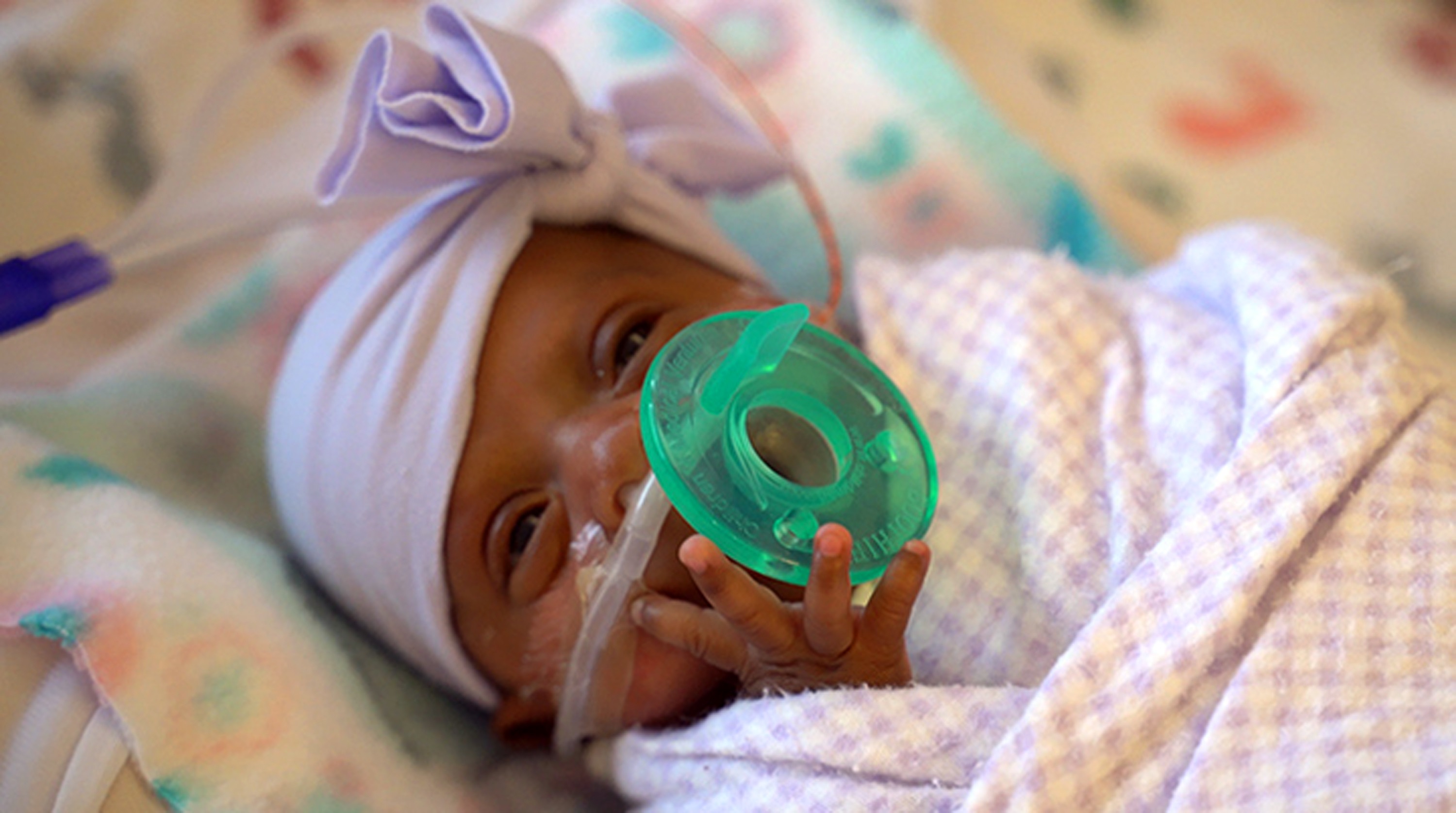 'Saybie' is believed to be the world's tiniest surviving baby 