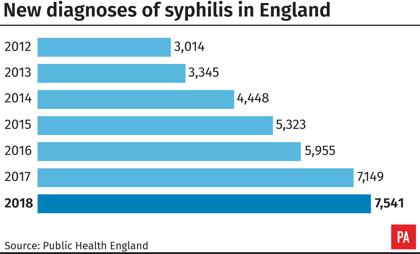 New diagnoses of syphilis in England (PA Graphics/ PA)