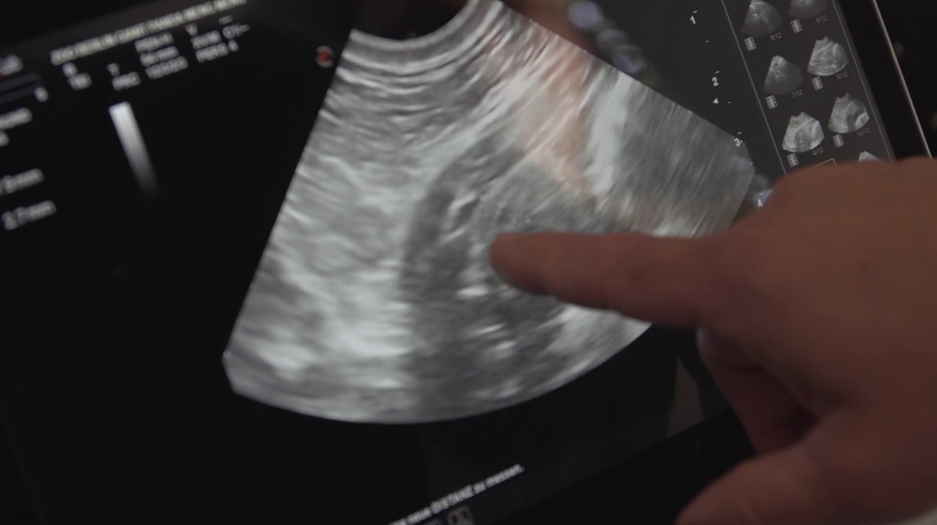 The ultrasound performed on Meng Meng the panda appears to show she is pregnant
