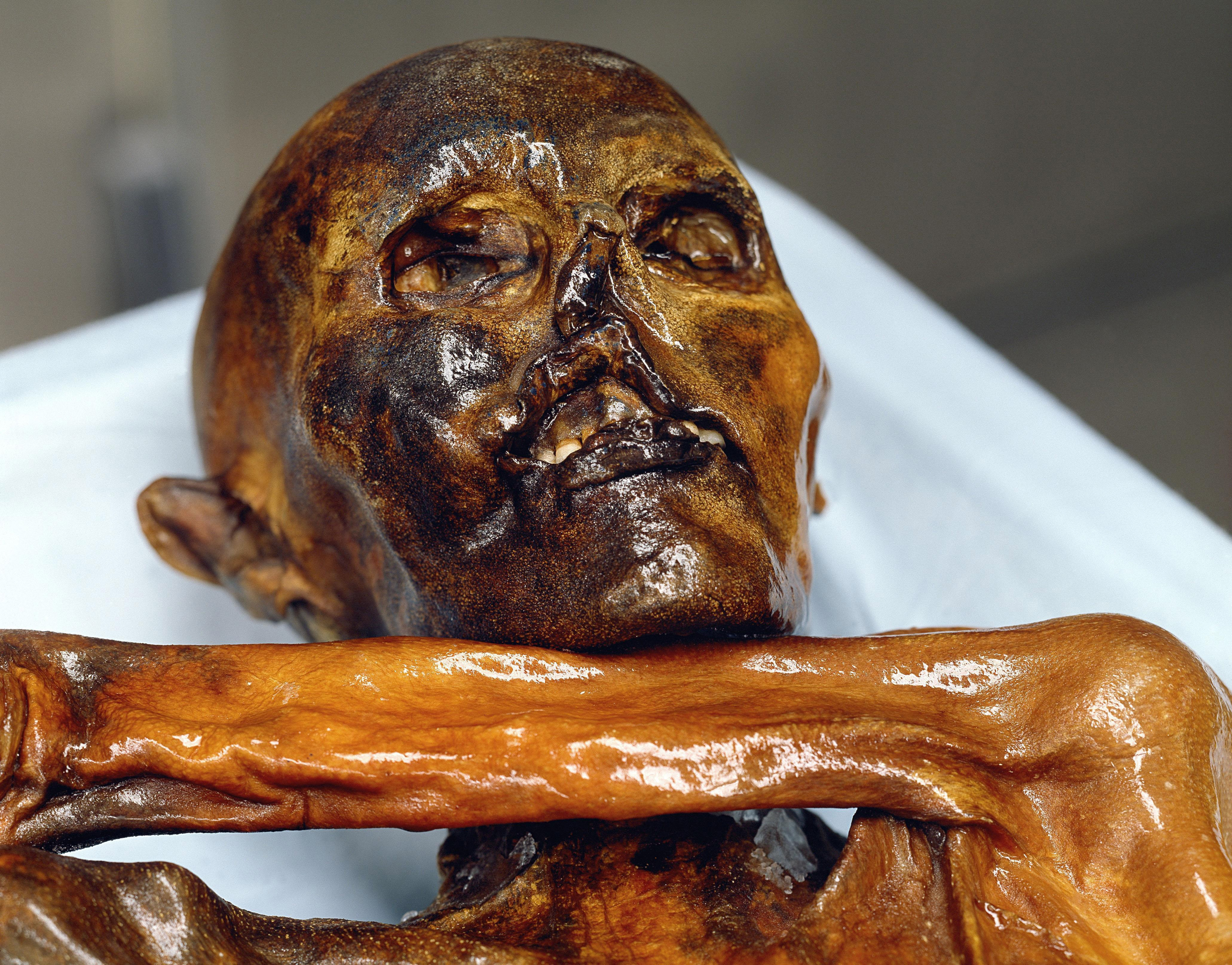 Otzi