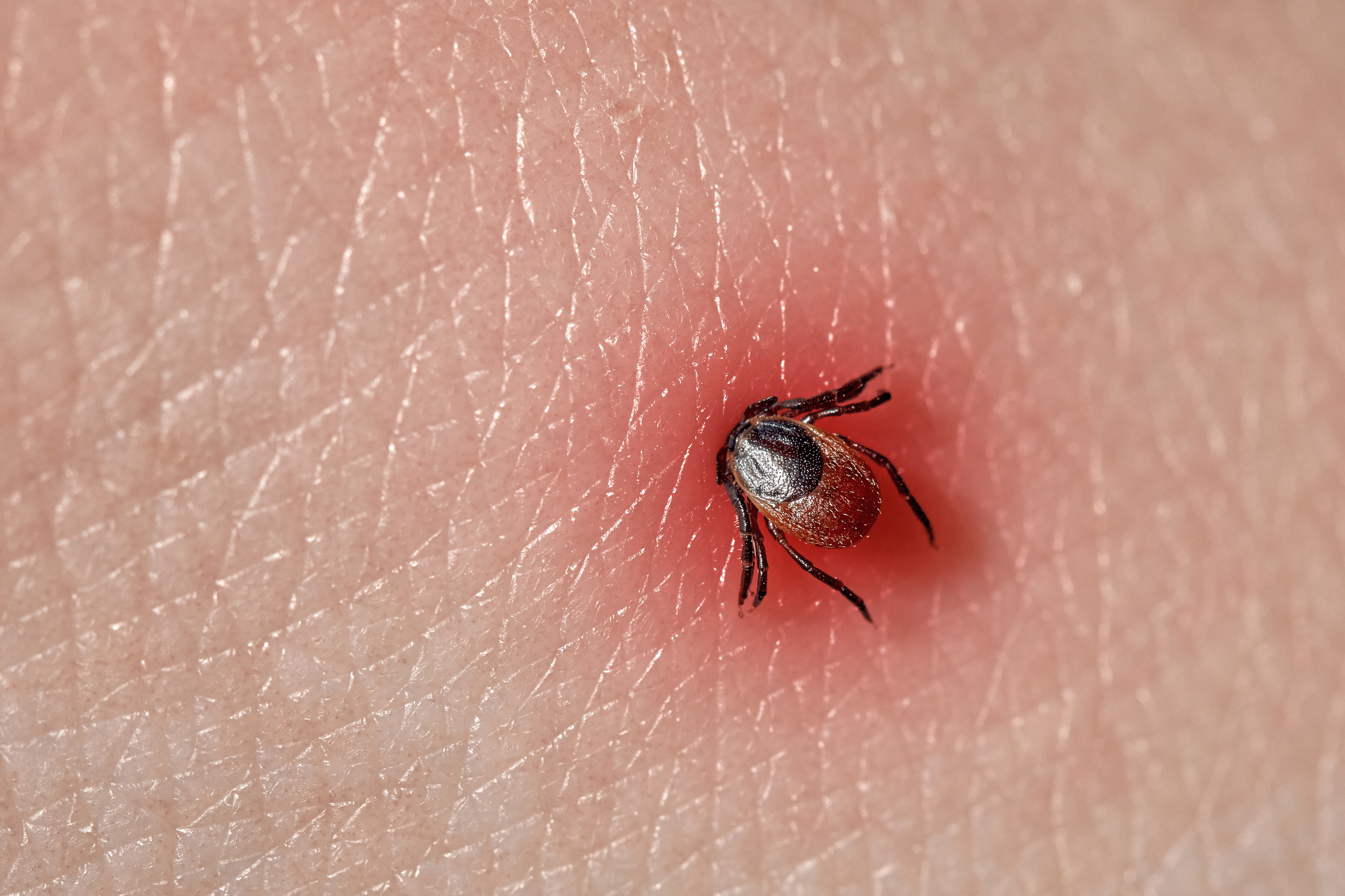 A tick on human skin (istock/PA)