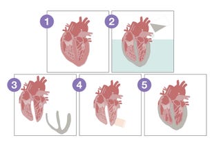 Heart Bioms Engineers design bionic ‘heart’ that beats like the real thing
