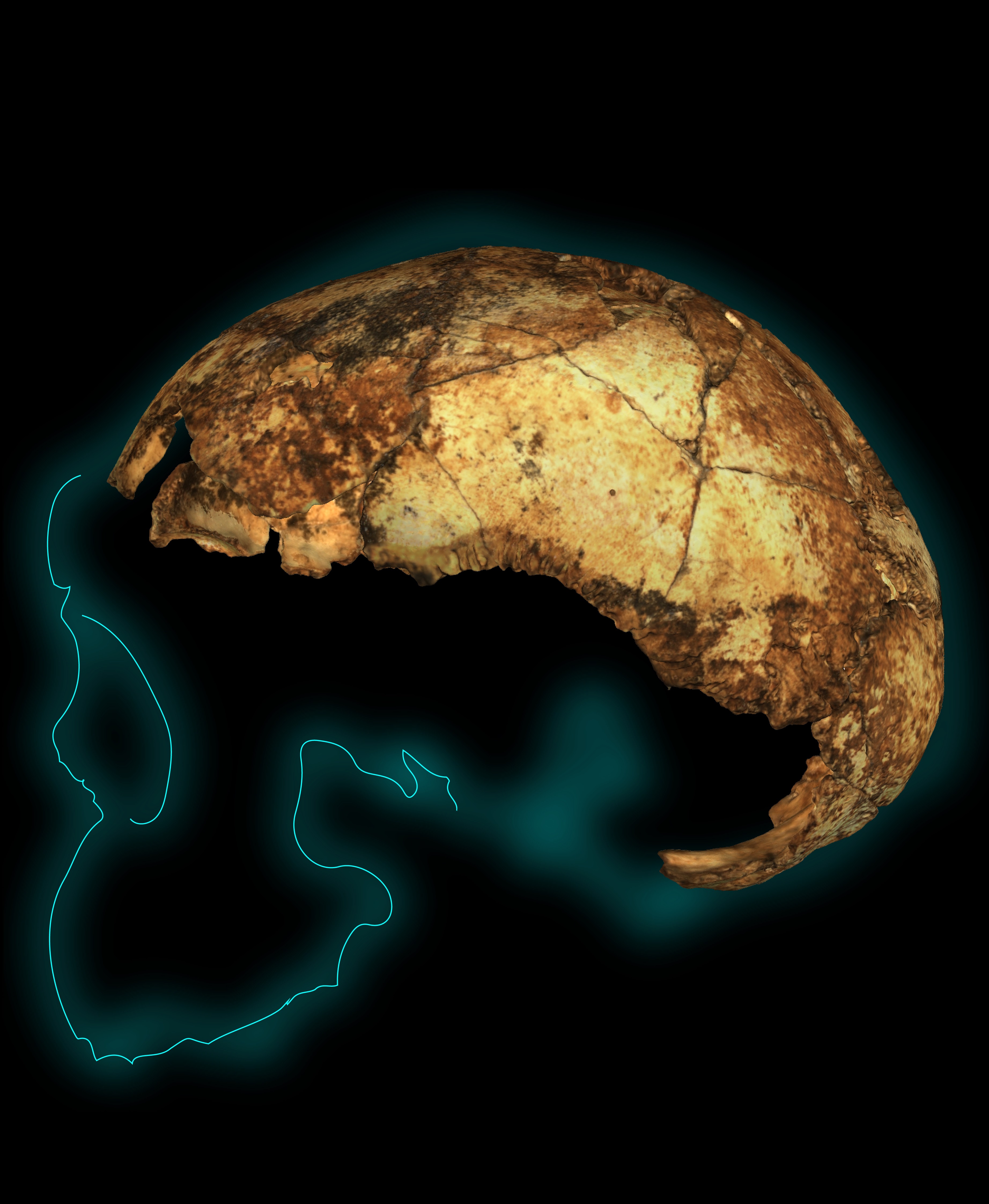 The DNH134 cranium