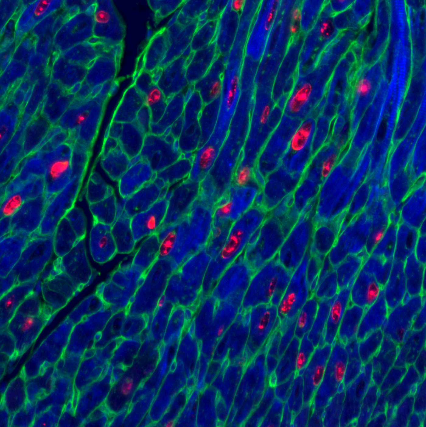 Adult mouse heart muscle cells (blue) after activation of proteins vital for cell replication. Red shows cells replica ting, green marks cell membrane