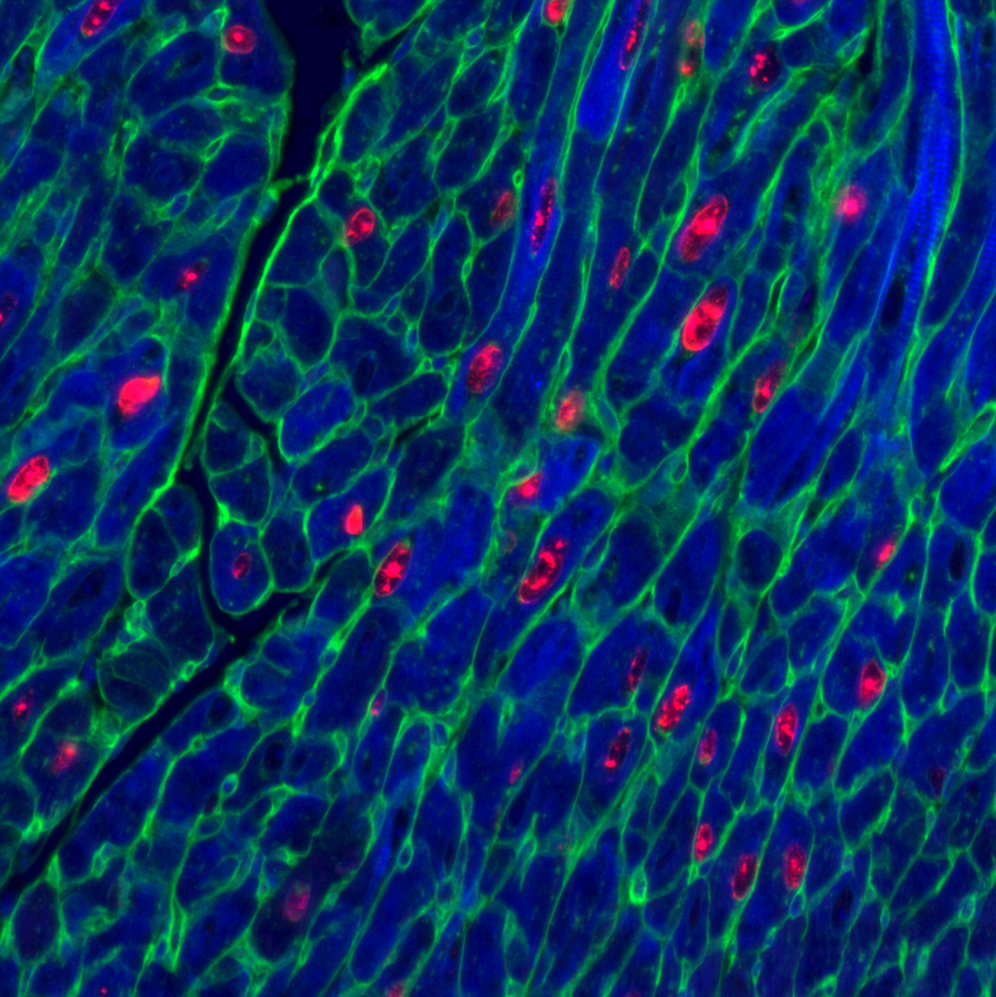 Muscles cells. Muscle Cell. Electron micrograph of smooth muscle Cells. Cellular muscular. Myocyte.