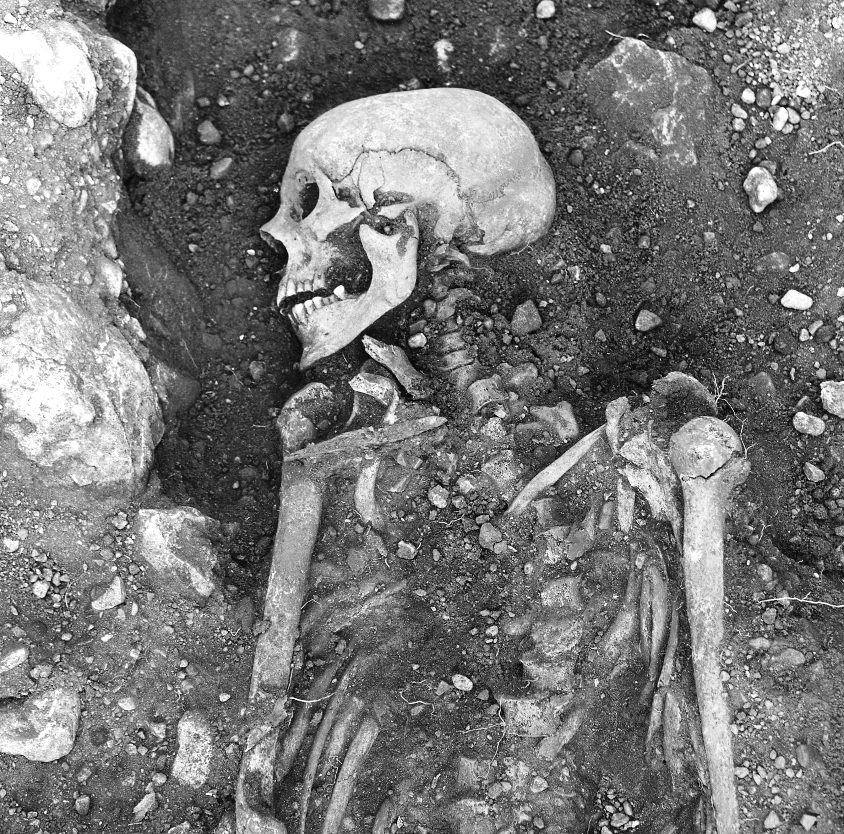 A 1.200-year-old smallpox-infected Viking skeleton found in Oland, Sweden