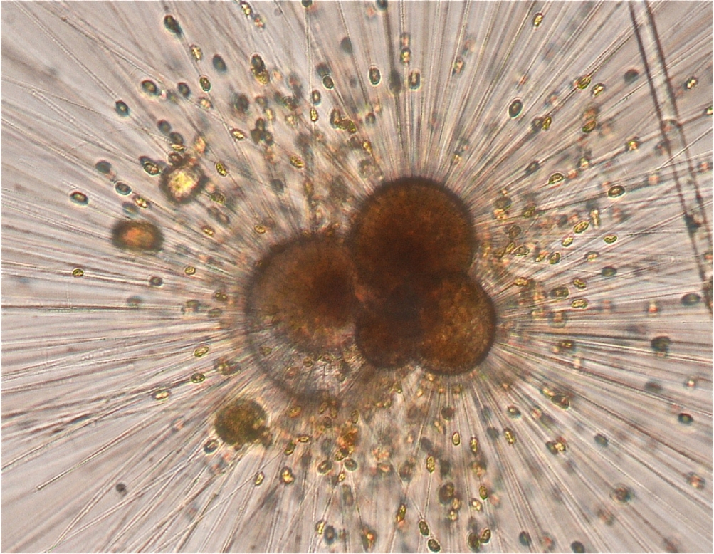 A living foraminifera