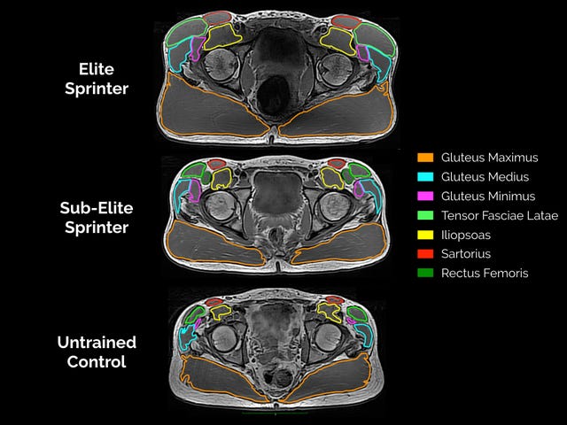 Bottom size matters: Large gluteus maximus key for sprint speed, study ...