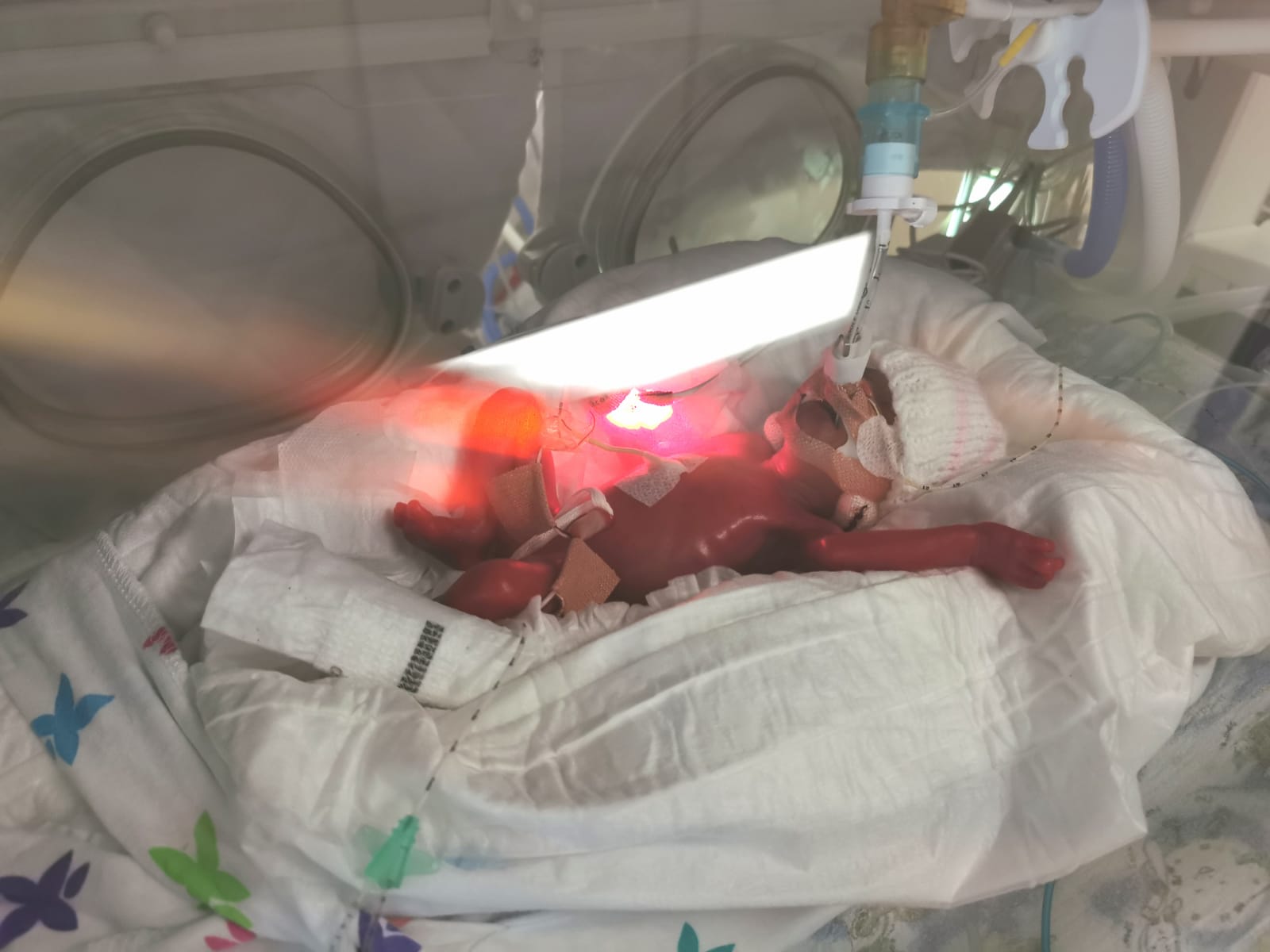 Baby Sofia in an incubator