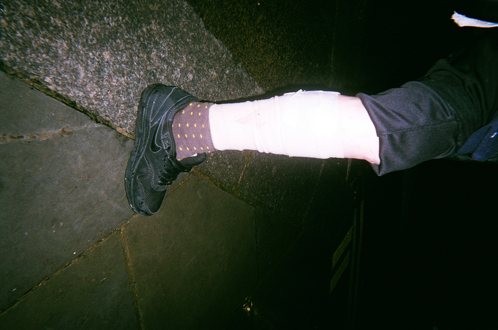 A photograph of a leg, taken by Kelly before she died