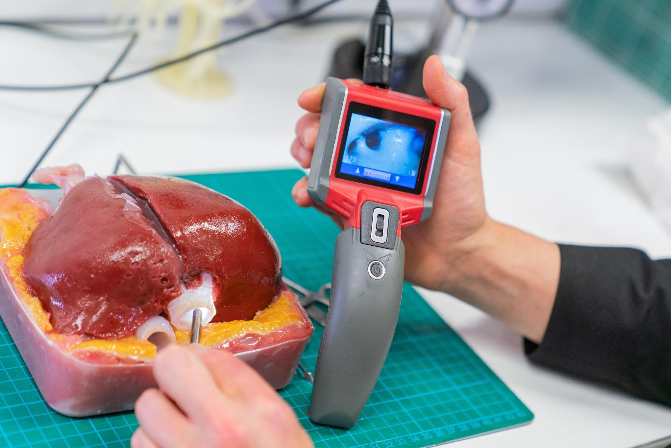 3D printed liver