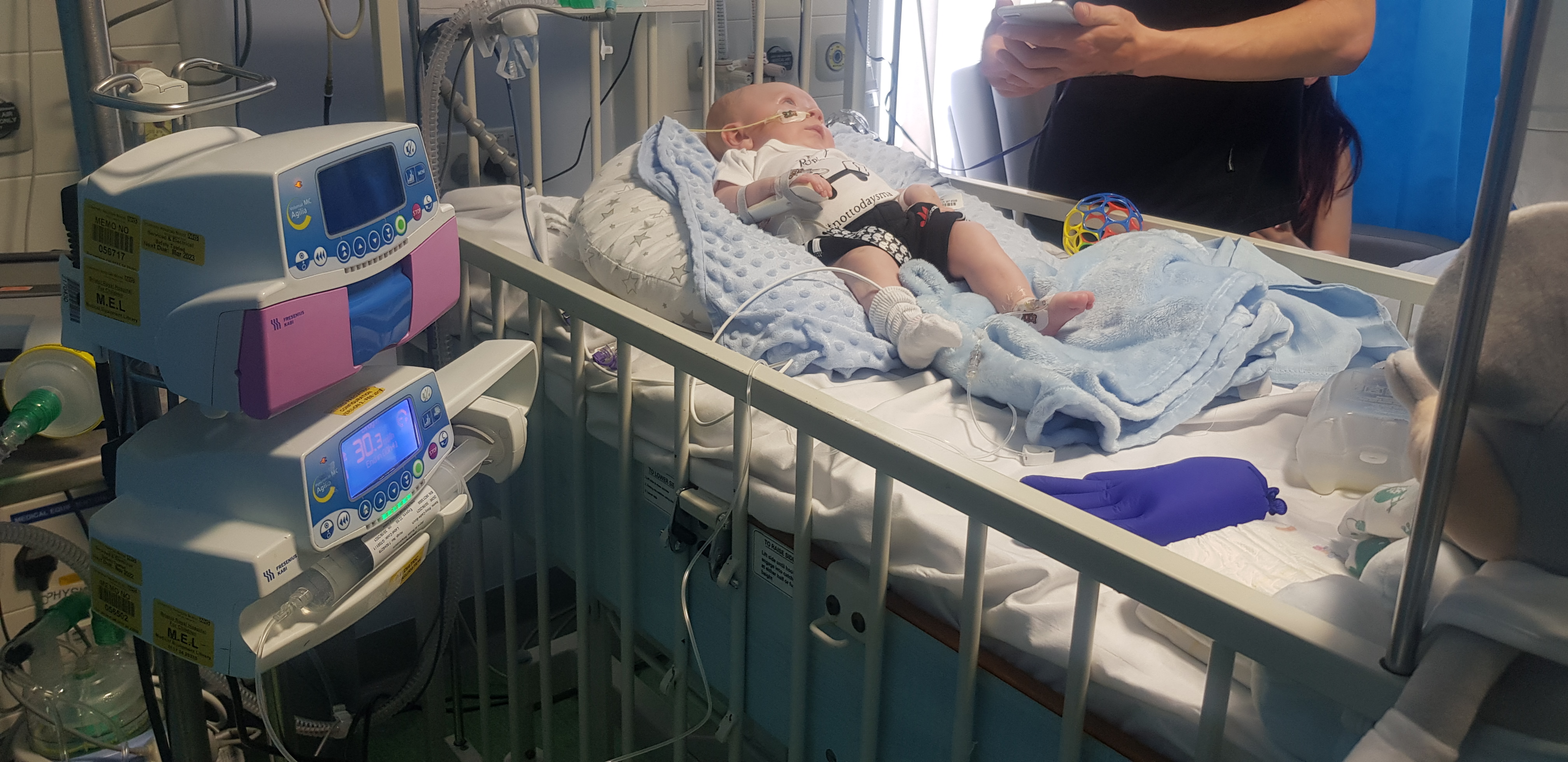 Riley Cadle-Birch received the gene therapy in June after being diagnosed a few weeks after he was born (University Hospitals Bristol and Weston NHS Foundation Trust/PA)