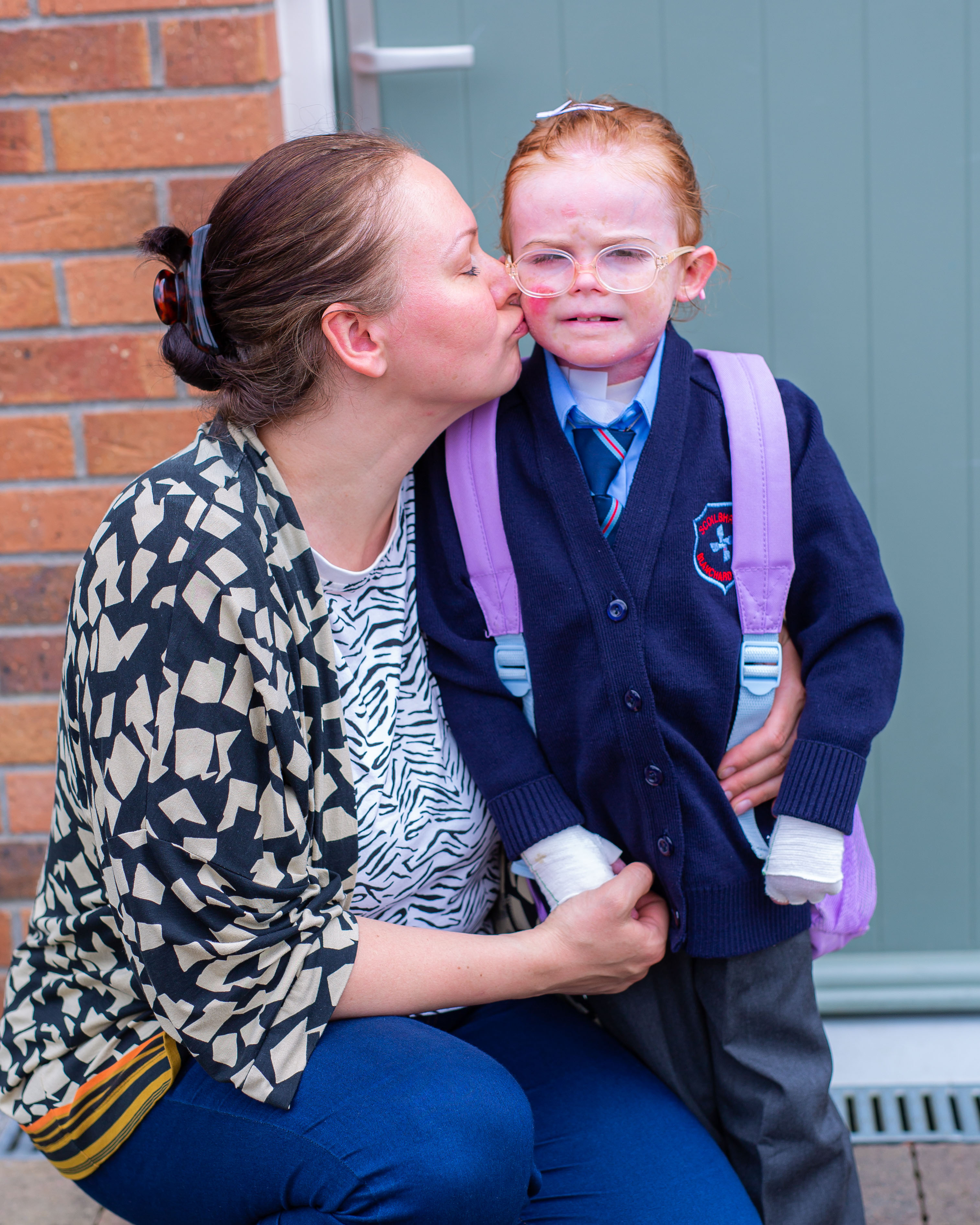 Roscommon Herald — Girl with rare skin disease stars in book explaining ...