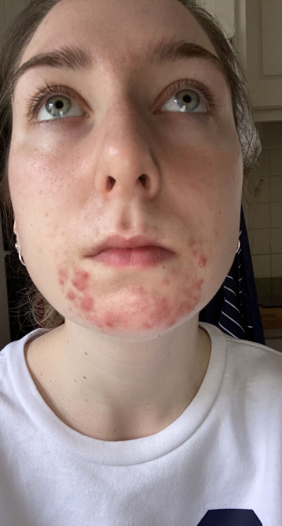 Kate found a solution for her acne using data and artificial intelligence